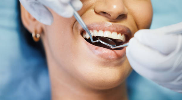 Best Emergency Wisdom Tooth Extraction in Owenton, KY
